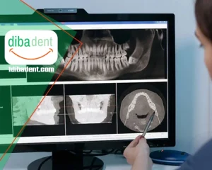 مقایسه سنسورهای RVG برندهای وودپیکر، کداک و رمدی